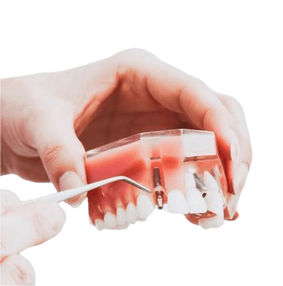 Injections PRP Cheveux