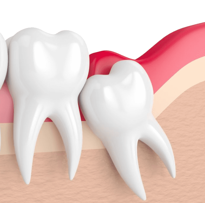 Injections PRP Cheveux